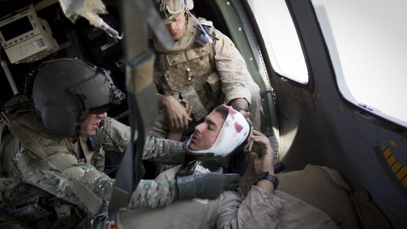 Pentagon Plans to Combat Traumatic Brain Injury